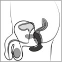 ANOS mini Prostate Plug